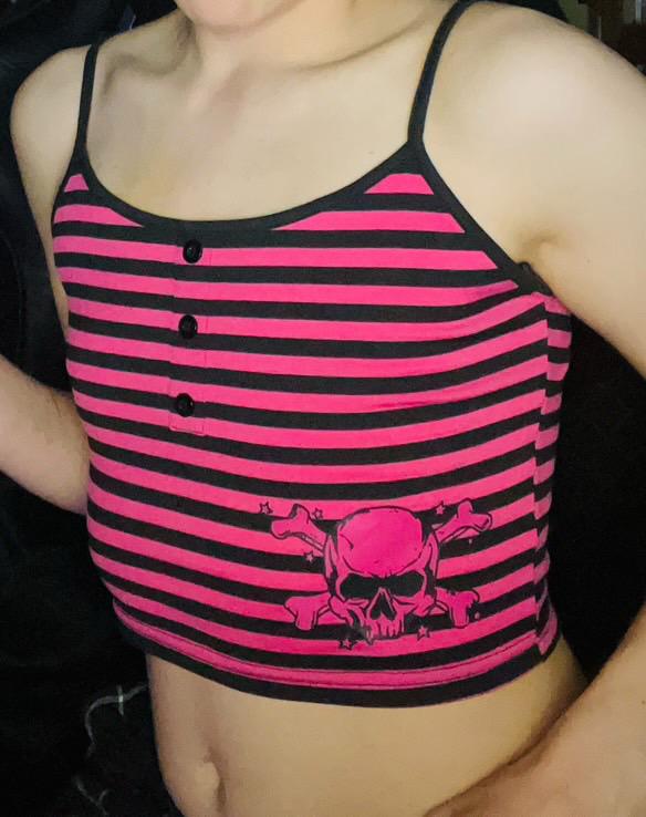 🖤 Striped Skull Crop Top – Emo Vibes & Pink Power 💀🌸